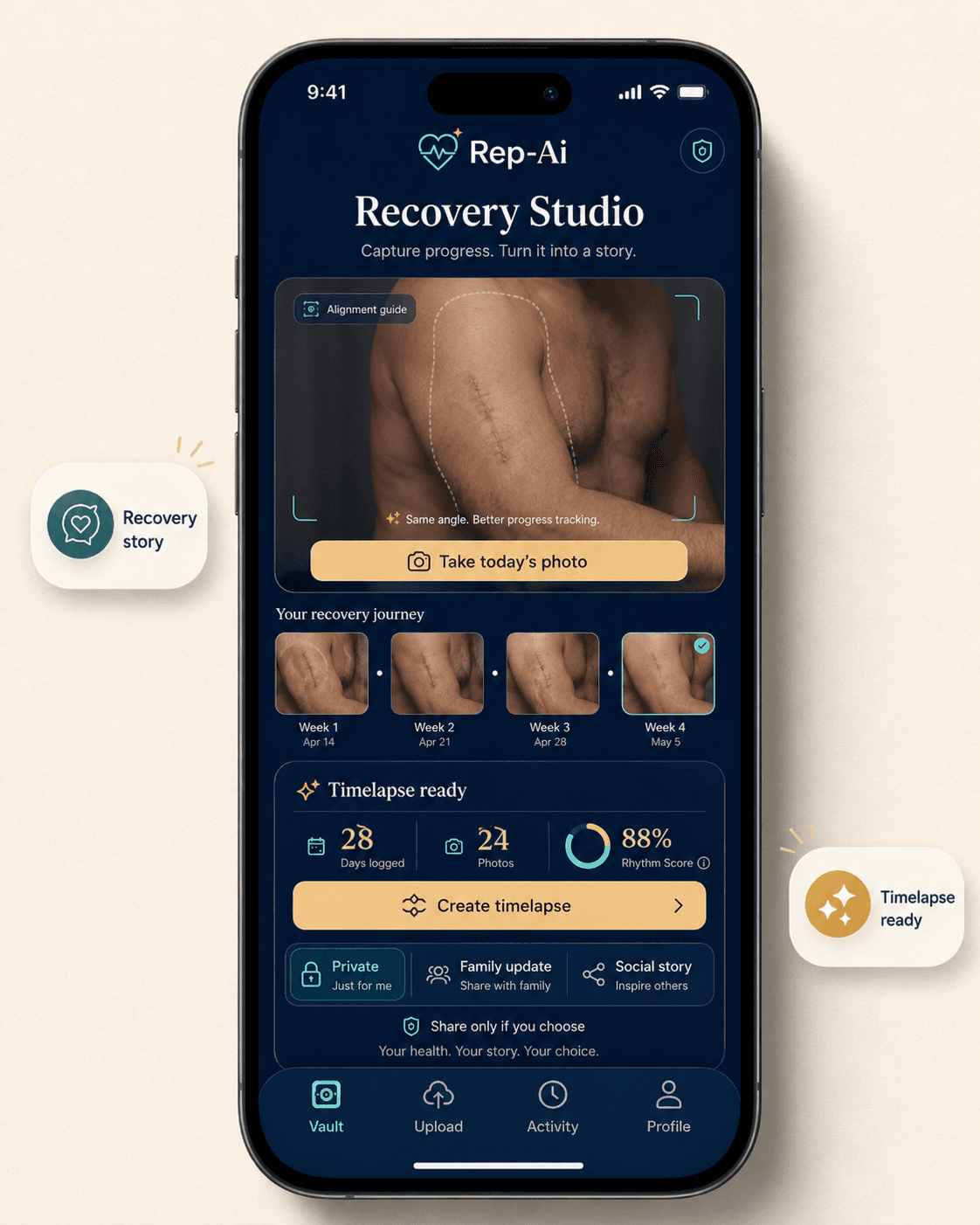 Rep-Ai Recovery